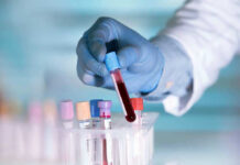 Medical Lobby Panics As Funding Door Slams Gloved hand holding a blood sample test tube.