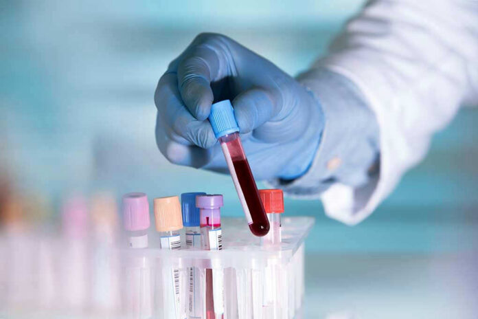 Gloved hand holding a blood sample test tube.